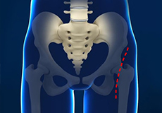 Same Day Hip Replacement Surgery